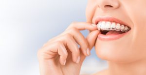 Close-up of woman smiling while putting in her clear aligner