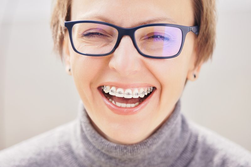 Stylish and beautiful young blonde girl in glasses and a gray sweater in braces, smiling on a white background, orthodontist dentist concept