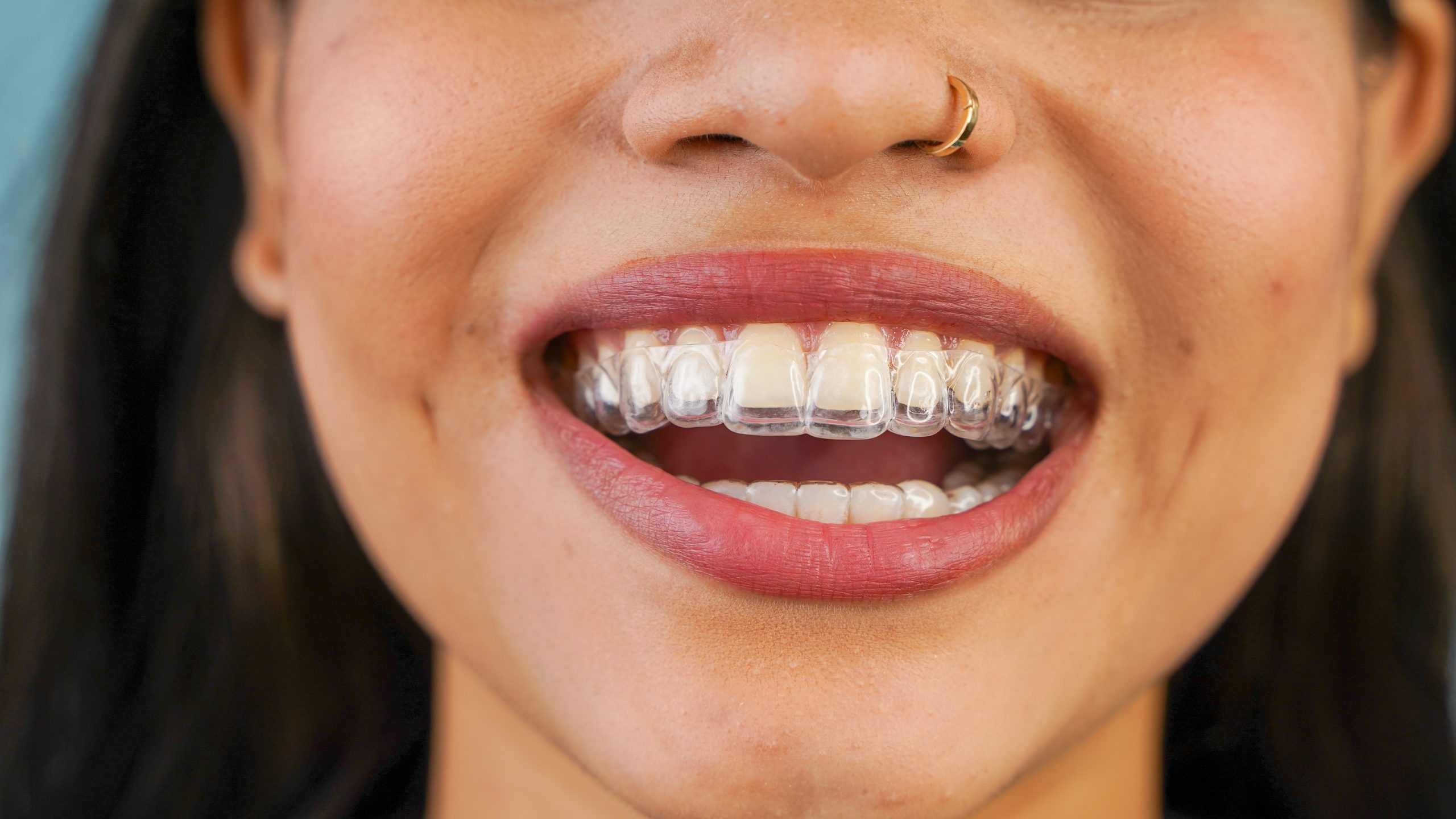 Young Asian Indian woman holding removable, Essix retainer