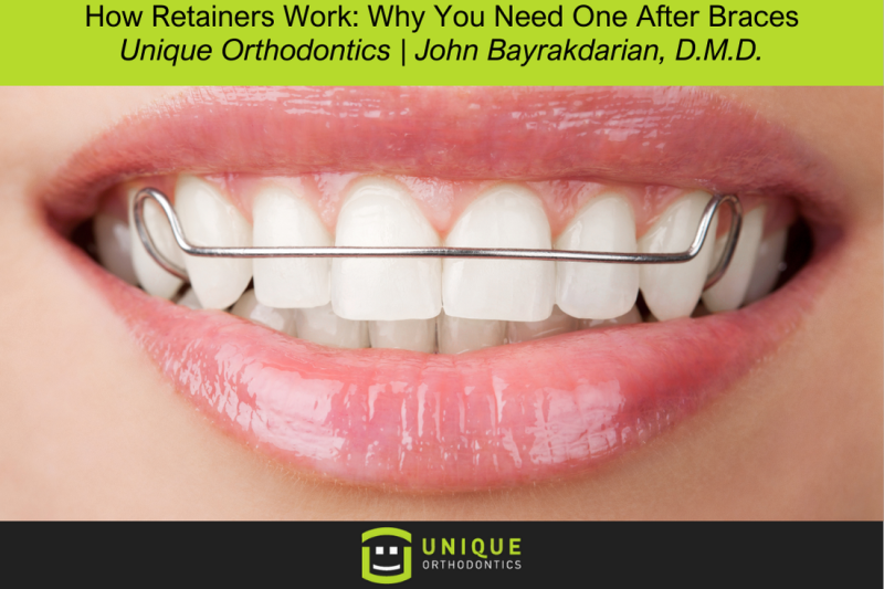 How Retainers Work: Why You Need One After Braces
