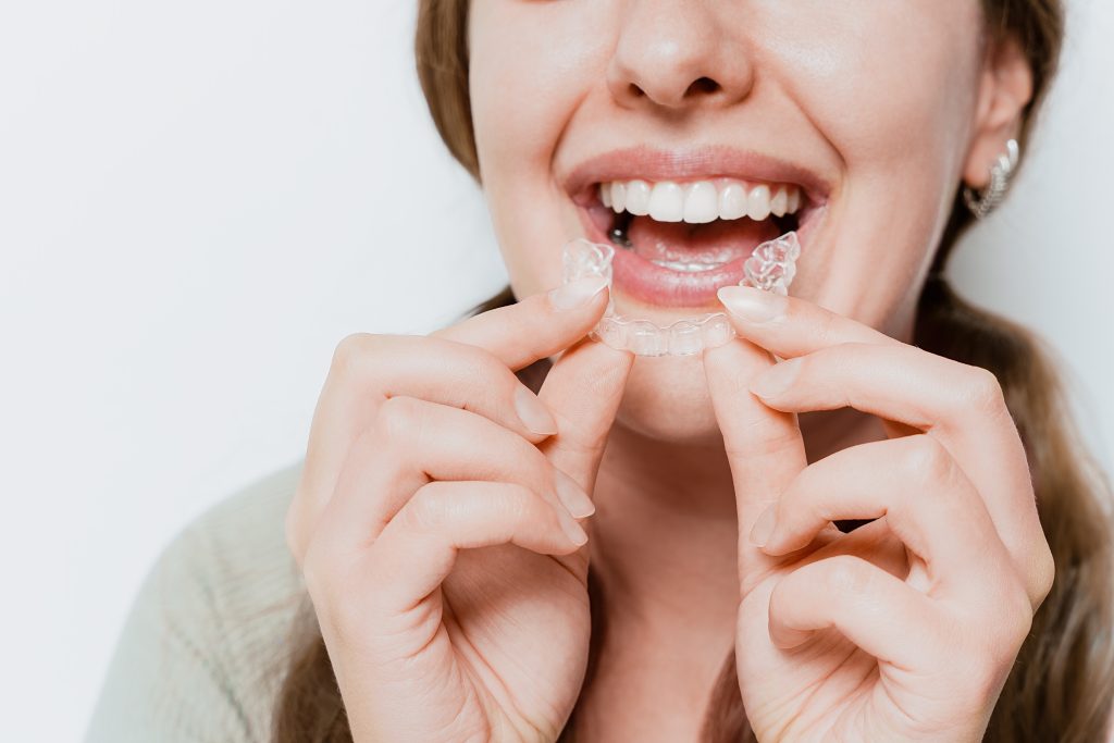 Girl smiling with her teeth while putting her aligner in