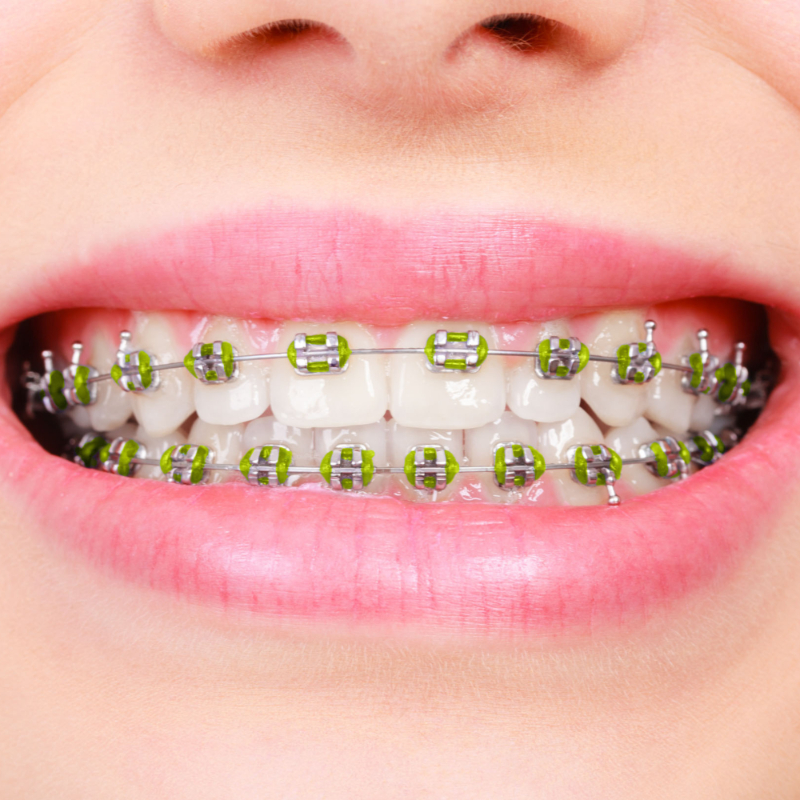 Best Orthodontist Fresno | Unique Orthodontics