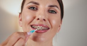 Young woman using a interdental, soft-bristled toothbrush to brush between her brackets of her braces. She is happily smiling while doing it.