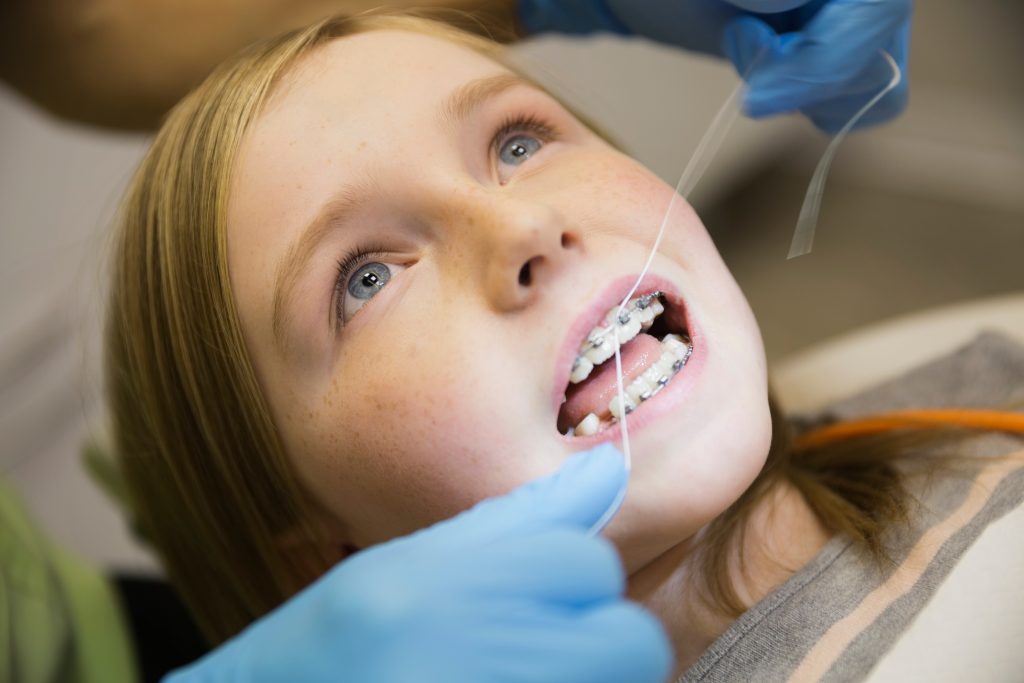 Dental assistant flossing between girls braces